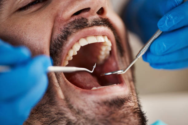 Best Emergency Wisdom Teeth Removal in Grandy, NC
